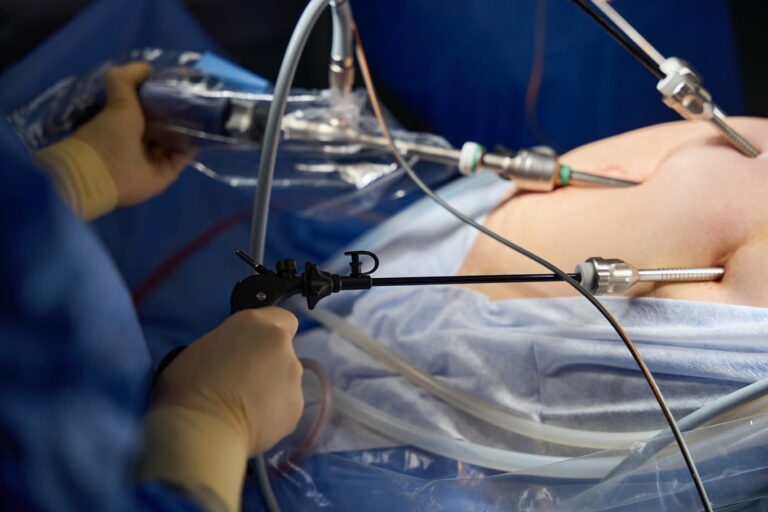 Cirurgia bariátrica sendo desenvolvida por médico especialista