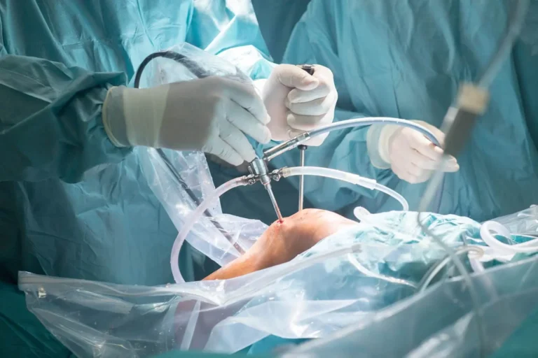 Cirurgia do Joelho, Quadril e Ombro são subespecialidades da Ortopedia e Traumatologia