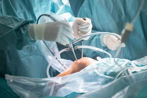 Cirurgia do Joelho, Quadril e Ombro são subespecialidades da Ortopedia e Traumatologia